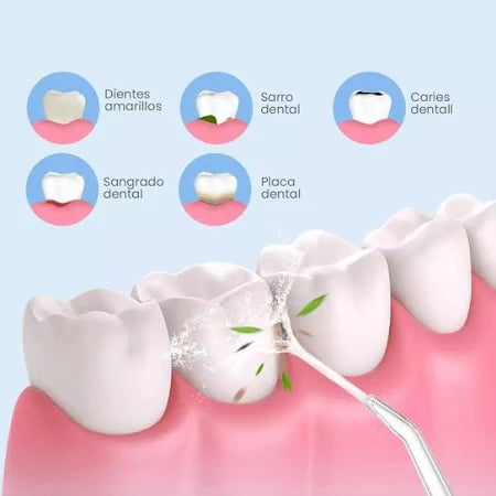 Irrigador Bucal Portatil